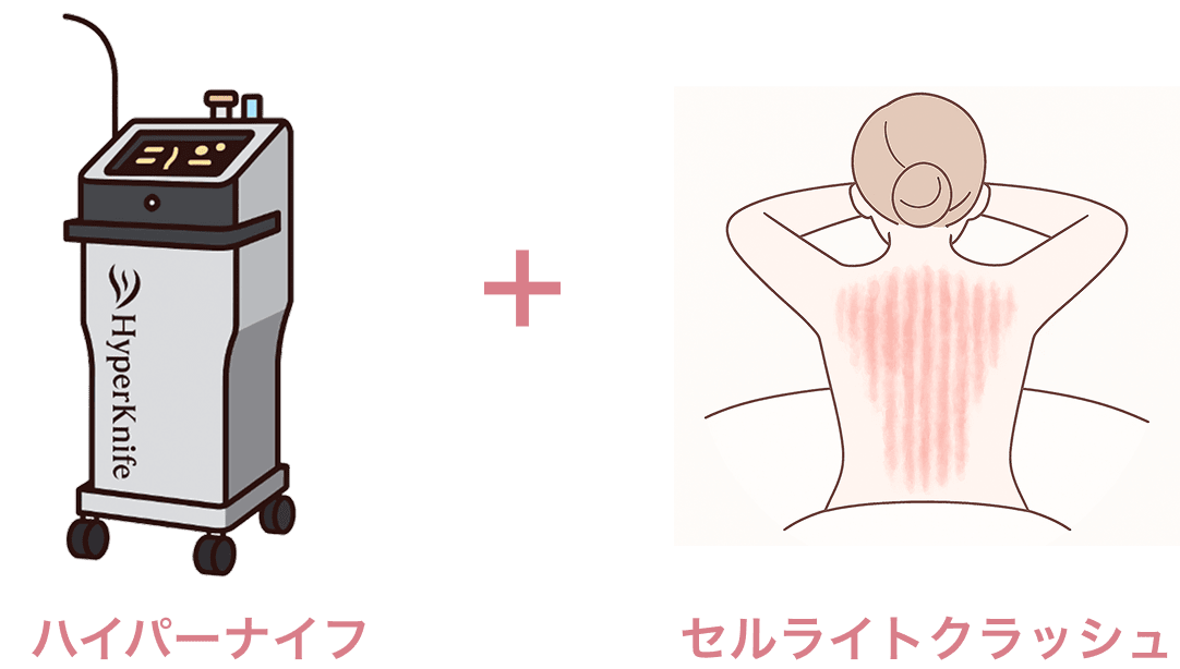 ハイパーナイフ セルライトクラッシュ
