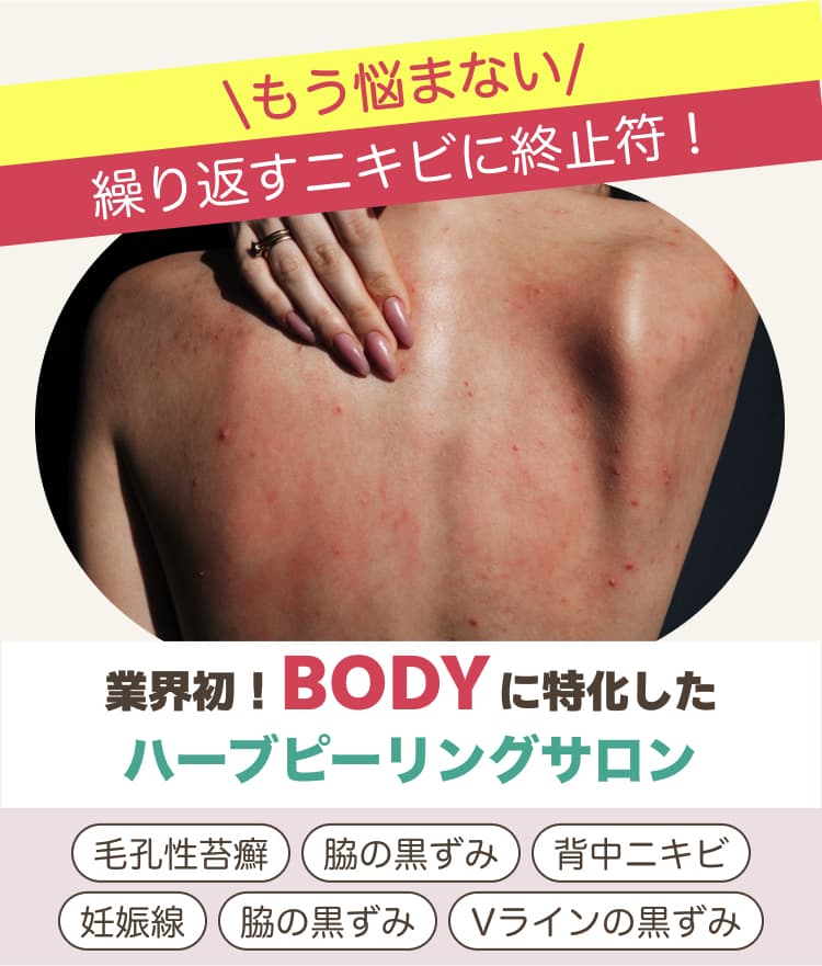 \もう悩まない/ 繰り返すニキビに終止符! 業界初!BODYに特化したハーブピーリングサロン 毛孔性苔癬 脇の黒ずみ 背中ニキビ 妊娠線 脇の黒ずみ Vラインの黒ずみ
