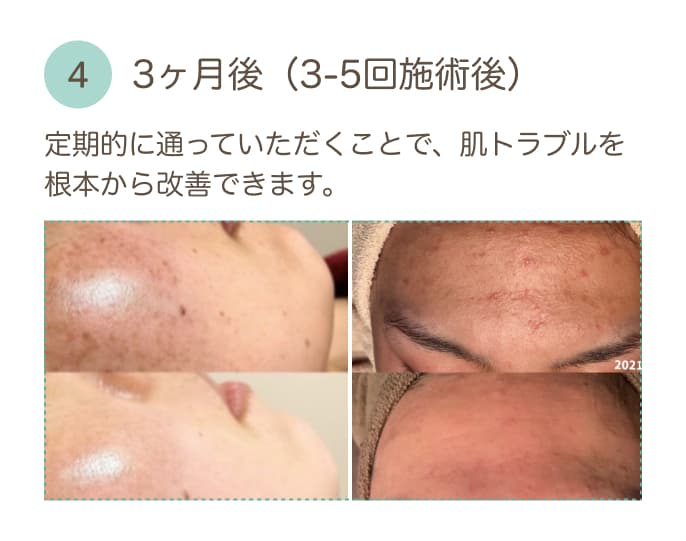 初回限定