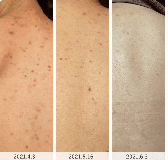 Before/After1