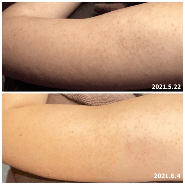 before-after2
